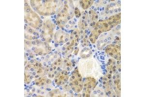 Immunohistochemistry (Paraffin-embedded Sections) (IHC (p)) image for anti-Aldo-Keto Reductase Family 1, Member A1 (Aldehyde Reductase) (AKR1A1) (AA 1-325) antibody (ABIN6136715)