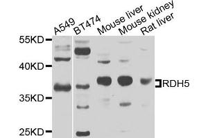 Western blot analysis of extracts of various cells, using RDH5 antibody. (RDH5 Antikörper)