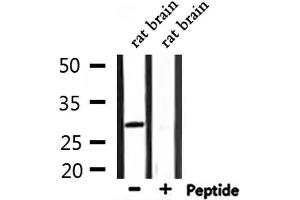 Western blot analysis of extracts from rat brain, using ATF1 Antibody. (AFT1 Antikörper  (Internal Region))
