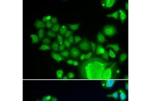 Immunofluorescence analysis of HeLa cells using FZR1 Polyclonal Antibody (FZR1 Antikörper)