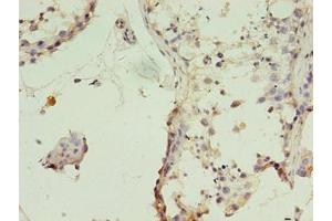 Immunohistochemistry of paraffin-embedded human testis tissue using ABIN7159886 at dilution of 1:100 (TIMM1B (AA 1-103) Antikörper)