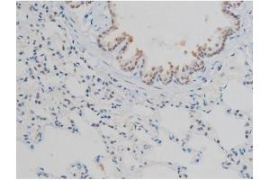 ABIN6267398 at 1/200 staining Rat lung tissue sections by IHC-P. (H2AFX Antikörper  (pSer139))
