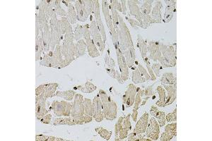 Immunohistochemistry of paraffin-embedded mouse heart using FGF2 antibody (ABIN1872685) at dilution of 1:100 (40x lens). (FGF2 Antikörper)