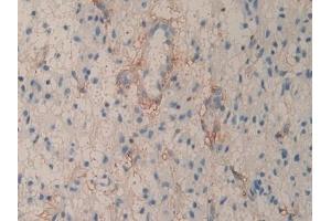 Immunohistochemistry (IHC) image for anti-CD90 (THY1) (AA 20-133) antibody (ABIN7437497)