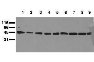 Western Blotting (WB) image for anti-Mitogen-Activated Protein Kinase Kinase 1 (MAP2K1) antibody (ABIN126837) (MEK1 Antikörper)
