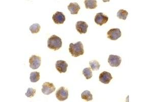 Immunohistochemistry (IHC) image for anti-B-Cell CLL/lymphoma 2 (BCL2) (Middle Region) antibody (ABIN1030884) (Bcl-2 Antikörper  (Middle Region))