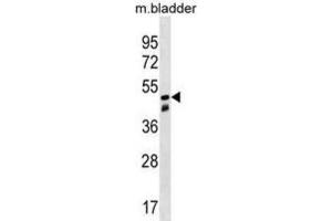 Western Blotting (WB) image for anti-Sorting Nexin 8 (SNX8) antibody (ABIN3000289) (SNX8 Antikörper)