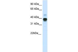 WB Suggested Anti-HOXA11 Antibody Titration:  0. (Homeobox A11 Antikörper  (C-Term))