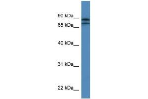 WB Suggested Anti-KLHL22 Antibody Titration: 0. (KLHL22 Antikörper  (N-Term))
