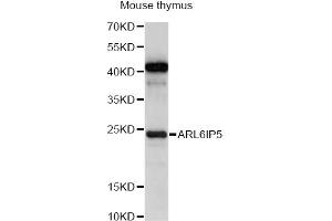 Western blot analysis of extracts of mouse thymus, using ARL6IP5 antibody (ABIN6292619) at 1:1000 dilution. (ARL6IP5 Antikörper)