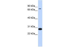 WB Suggested Anti-TCF12 Antibody Titration:  0. (TCF12 Antikörper  (Middle Region))