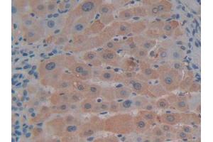 IHC-P analysis of Human Liver Tissue, with DAB staining. (CXCL12 Antikörper  (AA 23-89))