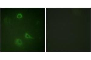Immunofluorescence analysis of A549 cells, using NMDAR1 (Phospho-Ser890) Antibody.