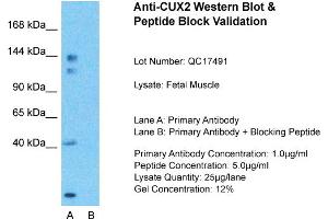 Host:  Rabbit  Target Name:  CUX2  Sample Type:  Fetal Muscle  Lane A:  Primary Antibody  Lane B:  Primary Antibody + Blocking Peptide  Primary Antibody Concentration:  1ug/ml  Peptide Concentration:  5ug/ml  Lysate Quantity:  25ug/lane/Lane  Gel Concentration:  0. (CUX2 Antikörper  (N-Term))