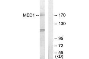 Western blot analysis of extracts from Jurkat cells, using MED1 Antibody. (MED1 Antikörper  (AA 641-690))