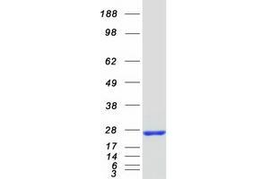 Western Blotting (WB) image for MOB Kinase Activator 3B (MOB3B) protein (Myc-DYKDDDDK Tag) (ABIN2726211)