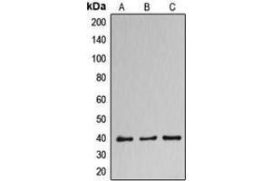 Western blot analysis of DNAJB11 expression in HuvEc (A), NCIH460 (B), MCF7 (C) whole cell lysates. (DNAJB11 Antikörper  (Center))