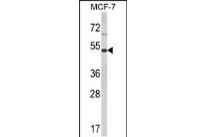LUC7L2 antibody  (C-Term)