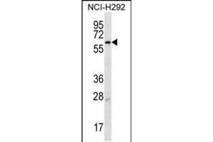 Western blot analysis in NCI-H292 cell line lysates (35ug/lane). (MBTPS2 Antikörper  (N-Term))