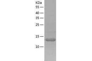 TMED10 Protein (AA 32-185) (His tag)