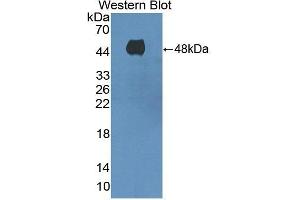 Detection of Recombinant ADCY8, Human using Polyclonal Antibody to Adenylate Cyclase 8, Brain (ADCY8)