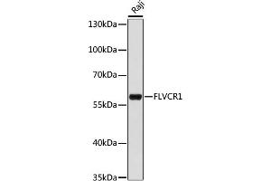 Western blot analysis of extracts of Raji cells, using FLVCR1 antibody (ABIN7267164) at 1:1000 dilution.