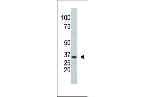 Western Blotting (WB) image for anti-Sulfotransferase Family, Cytosolic, 1A, Phenol-Preferring, Member 1 (SULT1A1) (AA 128-160) antibody (ABIN389136)