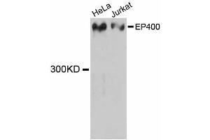 Western blot analysis of extracts of various cell lines, using EP400 antibody (ABIN5997682) at 1:3000 dilution. (EP400 Antikörper)