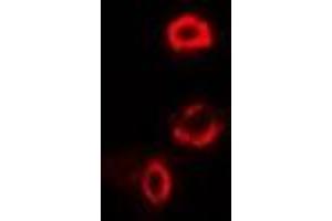 Immunofluorescent analysis of OGDH staining in U2OS cells.