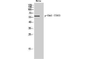 Western Blotting (WB) image for anti-Checkpoint Kinase 2 (CHEK2) (pThr383) antibody (ABIN3179592) (CHEK2 Antikörper  (pThr383))