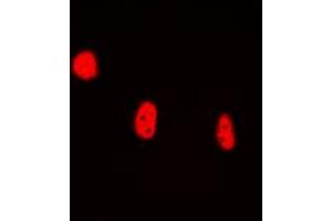 Immunofluorescent analysis of BRAF35 staining in HEK293T cells. (HMG20B Antikörper  (N-Term))