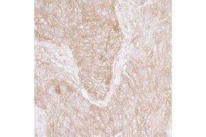 anti-Ribosomal Protein S3A (RPS3A) (AA 214-264) antibody