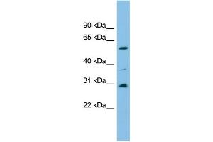 WB Suggested Anti-DUS1L Antibody Titration: 0. (DUS1L Antikörper  (Middle Region))