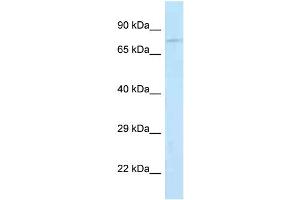 WB Suggested Anti-Jph2 Antibody Titration: 1.