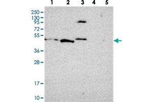 Western blot analysis of Lane 1: RT-4, Lane 2: U-251 MG, Lane 3: Human Plasma, Lane 4: Liver, Lane 5: Tonsil with FBRS polyclonal antibody  at 1:250-1:500 dilution. (Fibrosin Antikörper)
