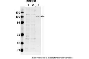 Sample type: 1. (Retinoblastoma Binding Protein 8 Antikörper  (C-Term))