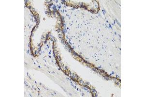 Immunohistochemistry of paraffin-embedded human prostate using  antibody (ABIN1512611, ABIN3021021, ABIN3021022, ABIN1513797 and ABIN6213916) at dilution of 1:100 (40x lens).
