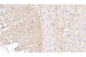 Detection of CDNF in Rat Spinal cord Tissue using Monoclonal Antibody to Cerebral Dopamine Neurotrophic Factor (CDNF) (CDNF Antikörper  (AA 20-183))