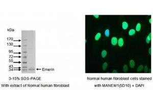 Image no. 1 for anti-Emerin (EMD) (AA 1-188) antibody (ABIN1042591) (Emerin Antikörper  (AA 1-188))