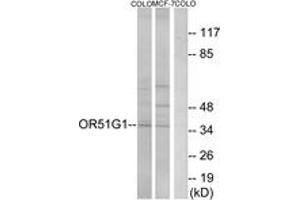 Western blot analysis of extracts from COLO/MCF-7 cells, using OR51G1 Antibody.