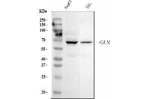 Western blot analysis of Glutaminase/GLS using anti-Glutaminase/GLS antibody (ABIN7601602).
