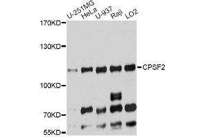 Western blot analysis of extracts of various cell lines, using CPSF2 antibody (ABIN5996261) at 1:7000 dilution. (CPSF2 Antikörper)