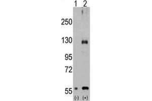 Western blot analysis of TRPM8 antibody and 293 cell lysate either nontransfected (Lane 1) or transiently transfected with the TRPM8 gene (2). (TRPM8 Antikörper  (AA 521-552))