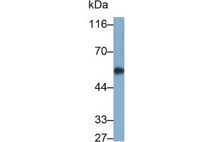 Detection of CYP1A1 in Rat Liver lysate using Polyclonal Antibody to Cytochrome P450 1A1 (CYP1A1)