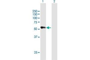 Western Blot analysis of CHRDL2 expression in transfected 293T cell line by CHRDL2 MaxPab polyclonal antibody. (CHRDL2 Antikörper  (AA 1-451))