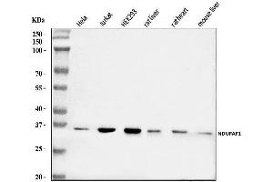Western blot analysis of NDUFAF1 using anti-NDUFAF1 antibody (ABIN7602459).