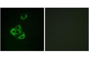 Immunofluorescence analysis of A549 cells, using MCL1 (Phospho-Ser159) Antibody. (MCL-1 Antikörper  (pSer159))