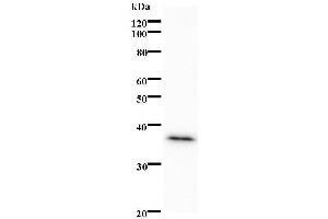 Western Blotting (WB) image for anti-Peroxisome Proliferator-Activated Receptor alpha (PPARA) antibody (ABIN931197) (PPARA Antikörper)