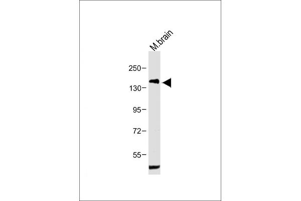 PDGFRA Antikörper  (AA 698-727)