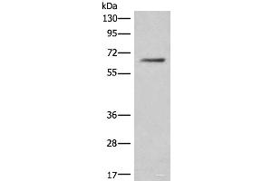 Western blot analysis of Hela cell lysate using CEP57 Polyclonal Antibody at dilution of 1:450 (CEP57 Antikörper)